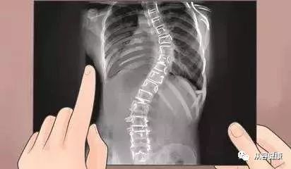 骨关节病为什么要补硒呢（硒与骨关节病）-硒宝网