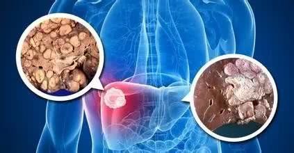 补硒是不是排毒素的药呢(毒素药补排是硒还是硫酸)-硒宝网