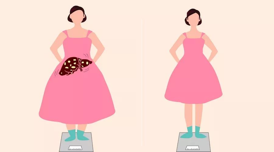 脂肪肝如何治疗怎么补硒（硒片对脂肪肝有作用吗）-硒宝网