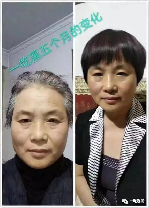 男人补硒吃什么保健品好（男人吃硒有什么好处）-硒宝网