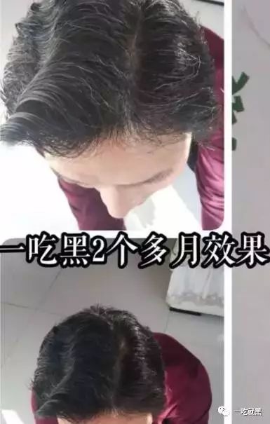 男人补硒吃什么保健品好（男人吃硒有什么好处）-硒宝网