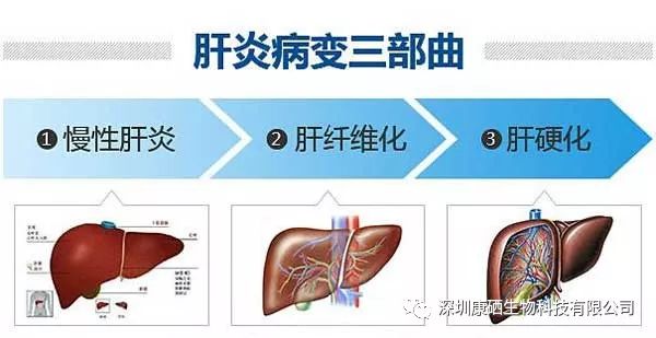 肝病患者需要补多久的硒(肝病吃硒管用吗)-硒宝网