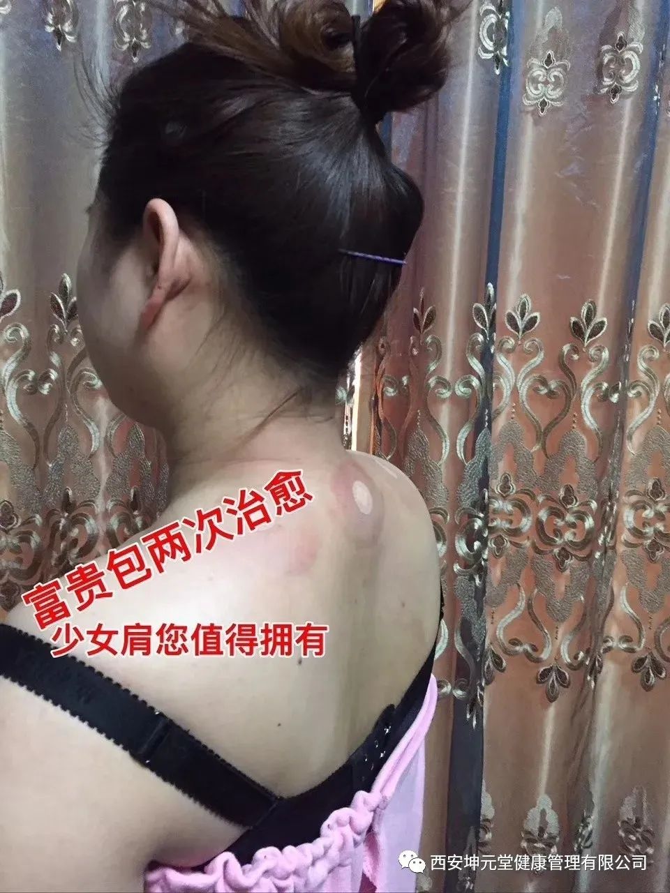 羊毛疔是不是缺硒怎样补（羊缺硒用什么药）-硒宝网