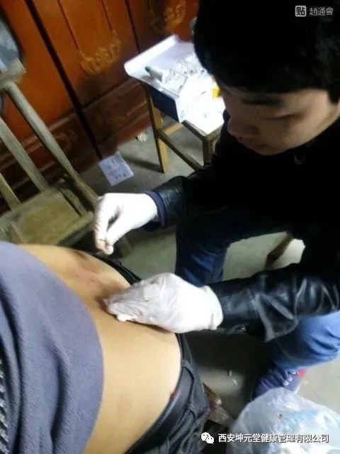 羊毛疔是不是缺硒怎样补（羊缺硒用什么药）-硒宝网