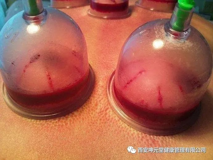 羊毛疔是不是缺硒怎样补（羊缺硒用什么药）-硒宝网