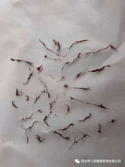 羊毛疔是不是缺硒怎样补（羊缺硒用什么药）-硒宝网