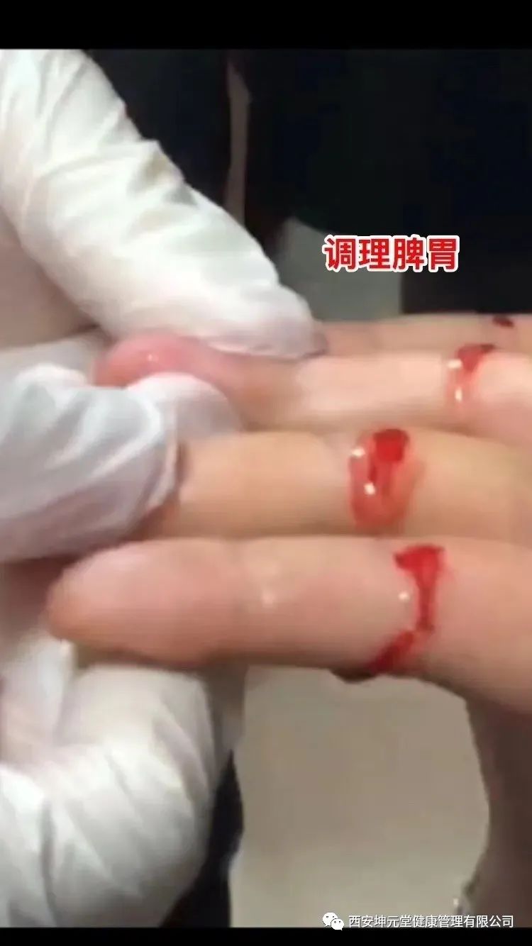 羊毛疔是不是缺硒怎样补（羊缺硒用什么药）-硒宝网