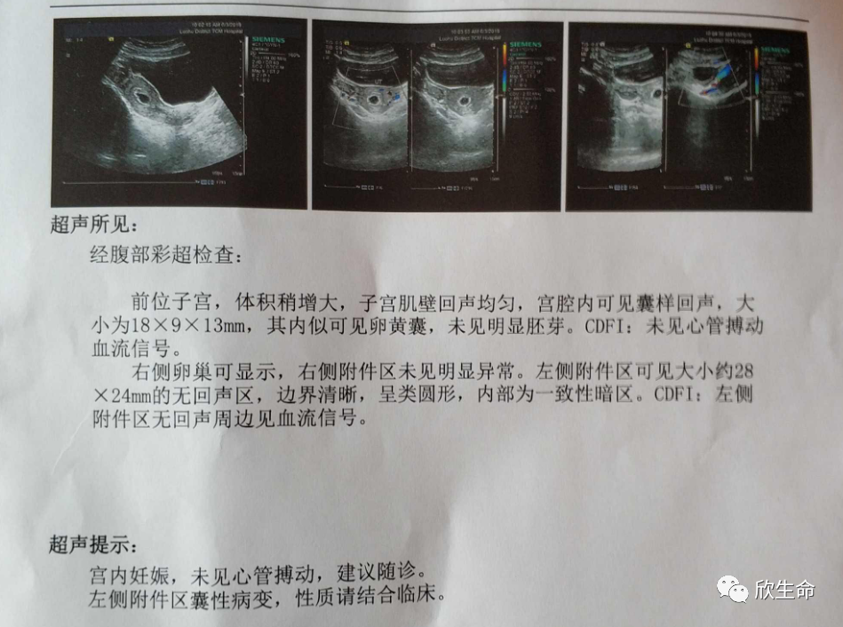 怀孕期间补多少硒最好呢（孕期补硒的作用）-硒宝网