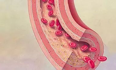 微创手术补硒吗有危害吗(危害手术补微创硒有什么作用)-硒宝网
