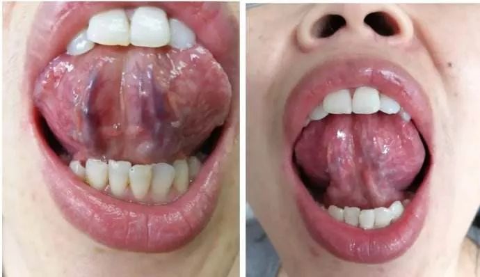 微创手术补硒吗有危害吗(危害手术补微创硒有什么作用)-硒宝网