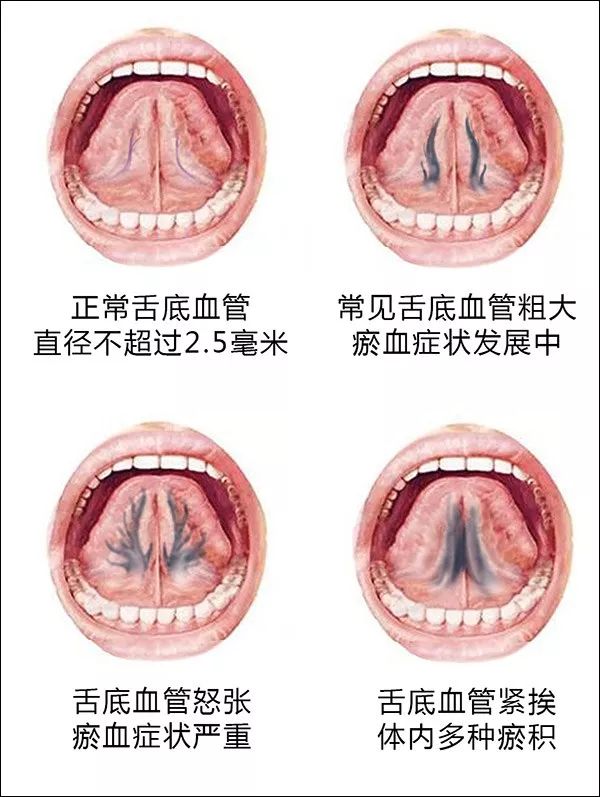 微创手术补硒吗有危害吗(危害手术补微创硒有什么作用)-硒宝网