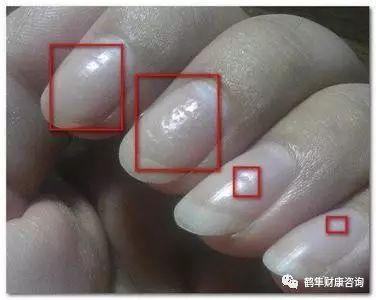 补硒会导致雄性激素过盛（雄性激素补多了会产生什么后果）-硒宝网