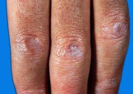 吃什么补维生素锌硒元素(锌维生素补元素吃硒片可以吗)-硒宝网