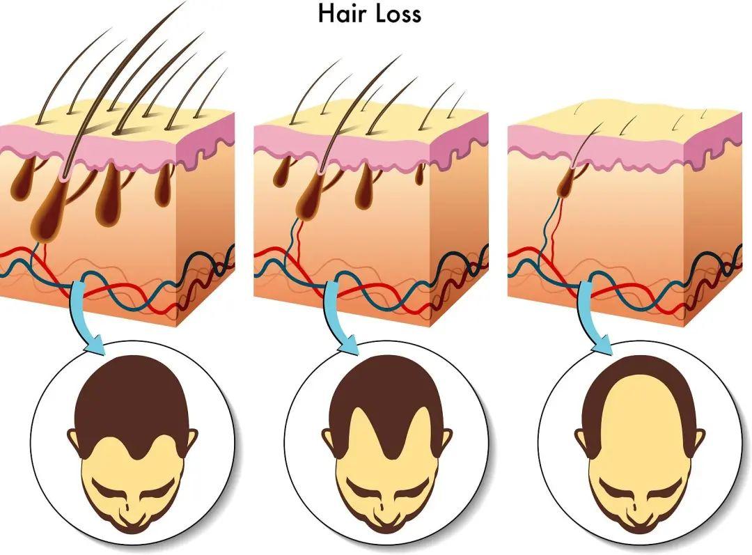 人需要每天都补硒吗知乎（人需要每天都补硒吗知乎）-硒宝网