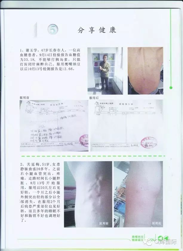 长期吃降压药缺硒怎么补(长期吃普利类降压药缺硒)-硒宝网