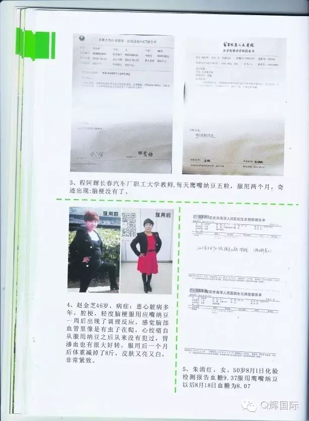 长期吃降压药缺硒怎么补(长期吃普利类降压药缺硒)-硒宝网