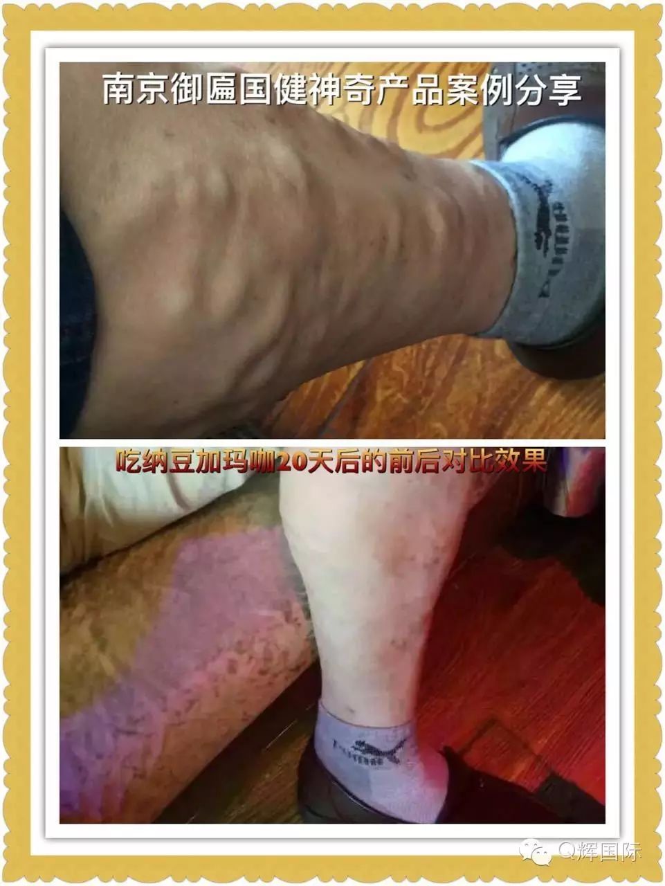 长期吃降压药缺硒怎么补(长期吃普利类降压药缺硒)-硒宝网