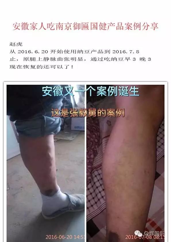 长期吃降压药缺硒怎么补(长期吃普利类降压药缺硒)-硒宝网