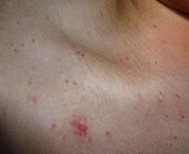 雌激素哪些人不能补硒的（雌激素能补硒人参肽吗）-硒宝网