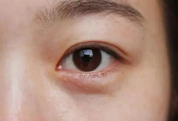 补硒对肝好水果有帮助吗(硒对肝的作用和补硒的好处)-硒宝网