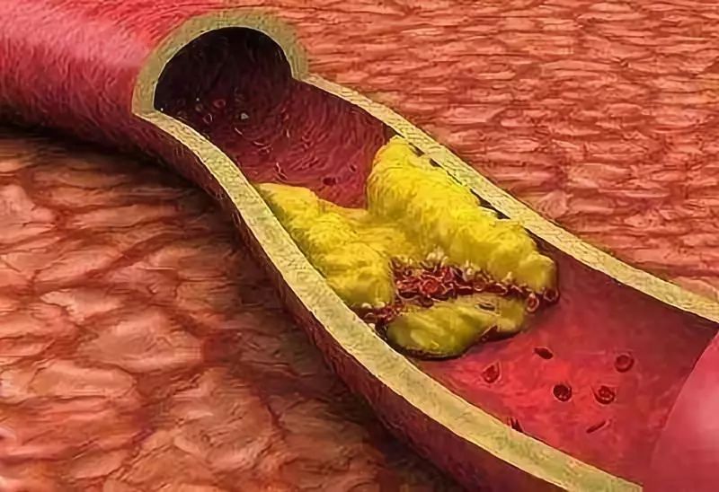 补硒对心肺病者有好处吗(补硒对心脏有什么好处)-硒宝网