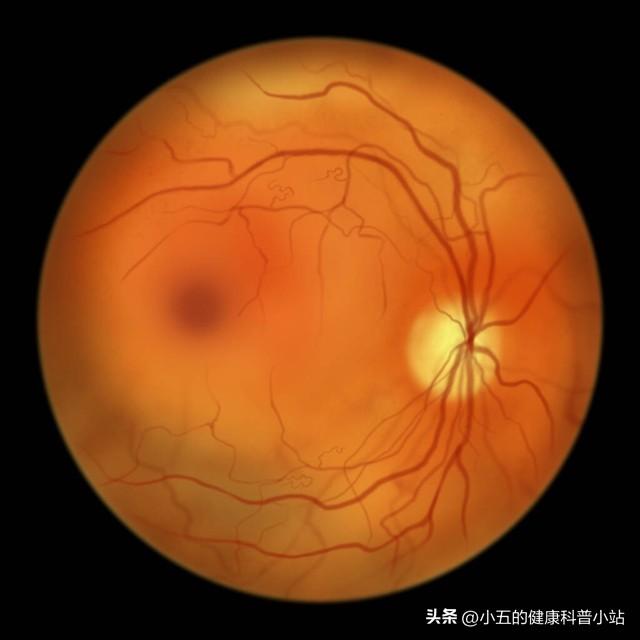 补硒维生素的食物有哪些（维生素补食物硒有什么好处）-硒宝网