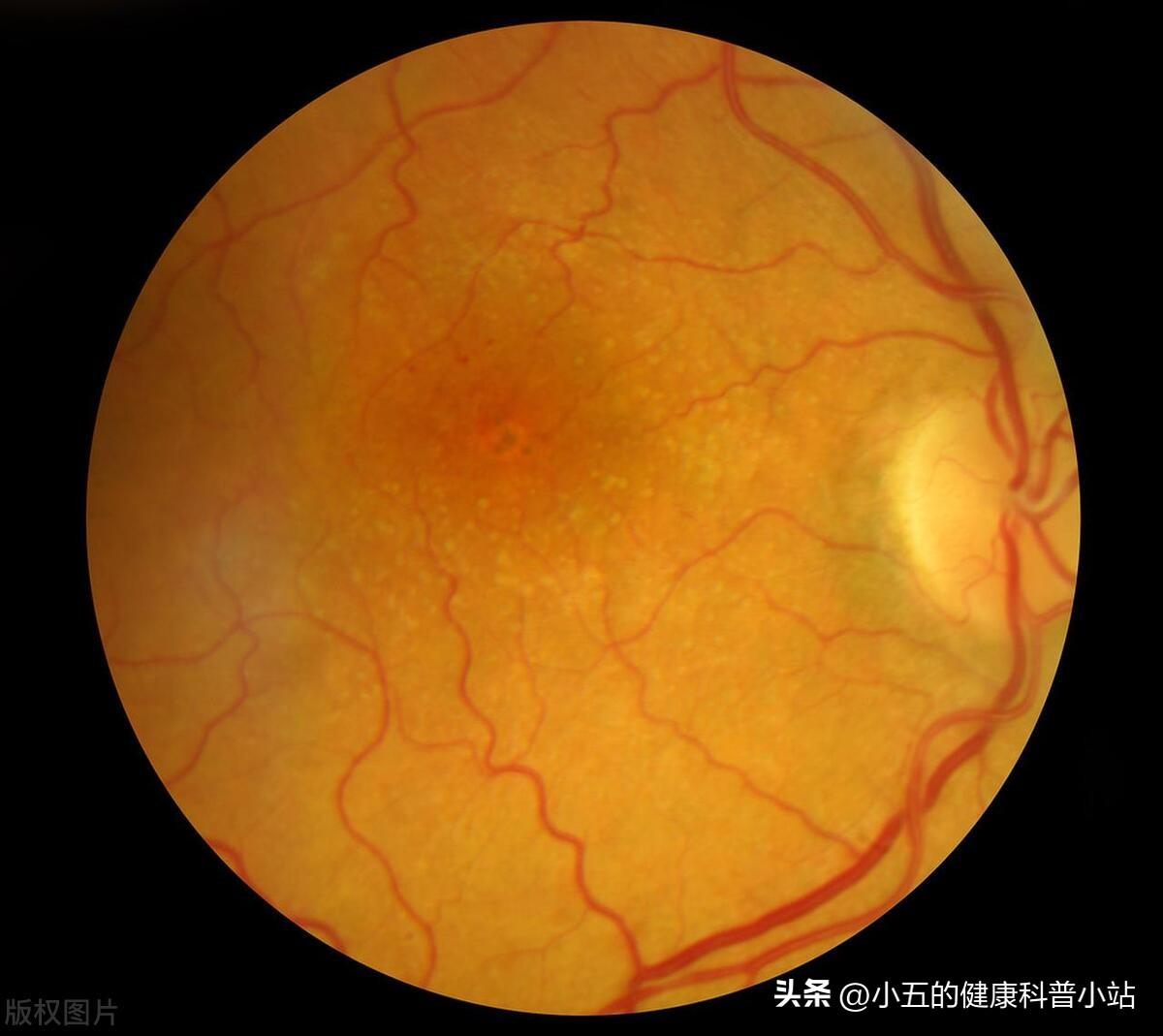 补硒维生素的食物有哪些（维生素补食物硒有什么好处）-硒宝网