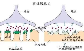补硒能使风湿病人加重吗(类风湿关节炎能否吃硒片)-硒宝网