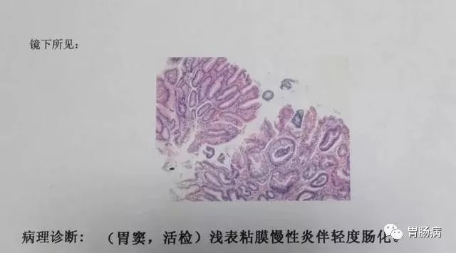 萎缩性胃炎怎样补硒的呢(萎缩性胃炎硒酵母)-硒宝网