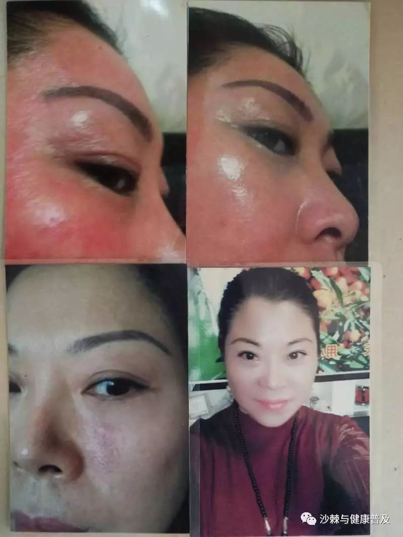 吃补硒三素到处疼为什么（吃补硒三素到处疼为什么）-硒宝网