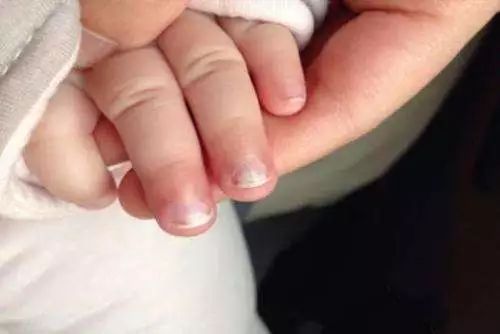 10个月婴儿缺硒怎么补（宝宝缺硒的怎么补充）-硒宝网