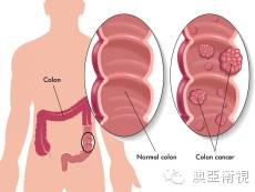 身体缺铁缺锌缺硒怎么补（缺锌缺硒有什么症状）-硒宝网