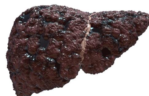 补硒对静脉曲张有效果吗（静脉精索曲张什么药疗效显著）-硒宝网