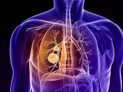 什么病不能补维生素硒呢（维生素硒能提高免疫力吗）-硒宝网