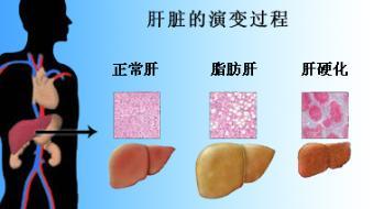 冠心病轻度脑梗能补硒吗(轻度能冠心病补脑梗硒元素吗)-硒宝网
