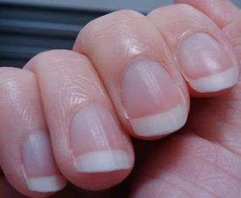 癌细胞扩散到肝能补硒吗（肝癌细胞扩散了还有救吗）-硒宝网