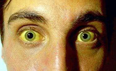 癌细胞扩散到肝能补硒吗（肝癌细胞扩散了还有救吗）-硒宝网