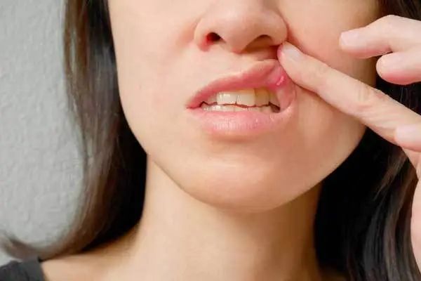 正常人能吃补硒的东西吗（硒能补吗）-硒宝网