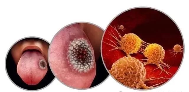 正常人能吃补硒的东西吗（硒能补吗）-硒宝网