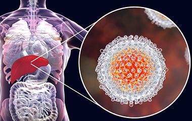 补硒后皮肤特别痒怎么办(为什么补硒会皮肤痒)-硒宝网