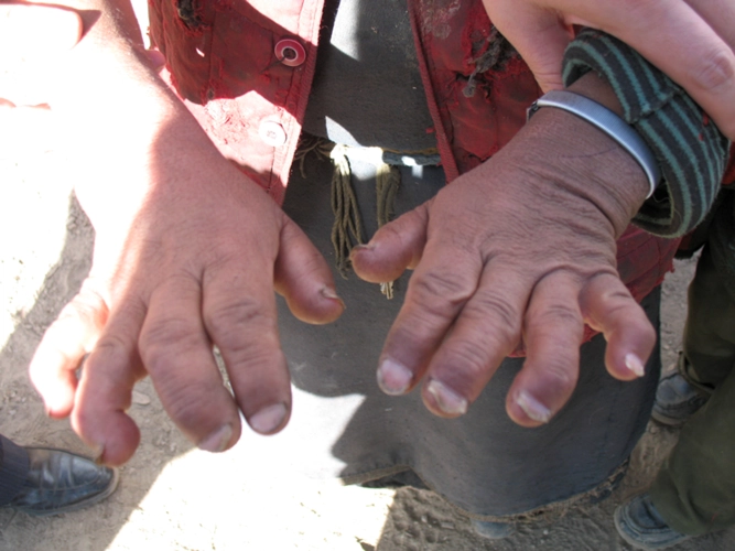 哪国的补硒产品好用一点（国家认可的补硒产品）-硒宝网