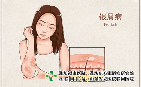 牛皮癣患者补硒有帮助吗(牛皮癣患者能用藏皂吗)-硒宝网