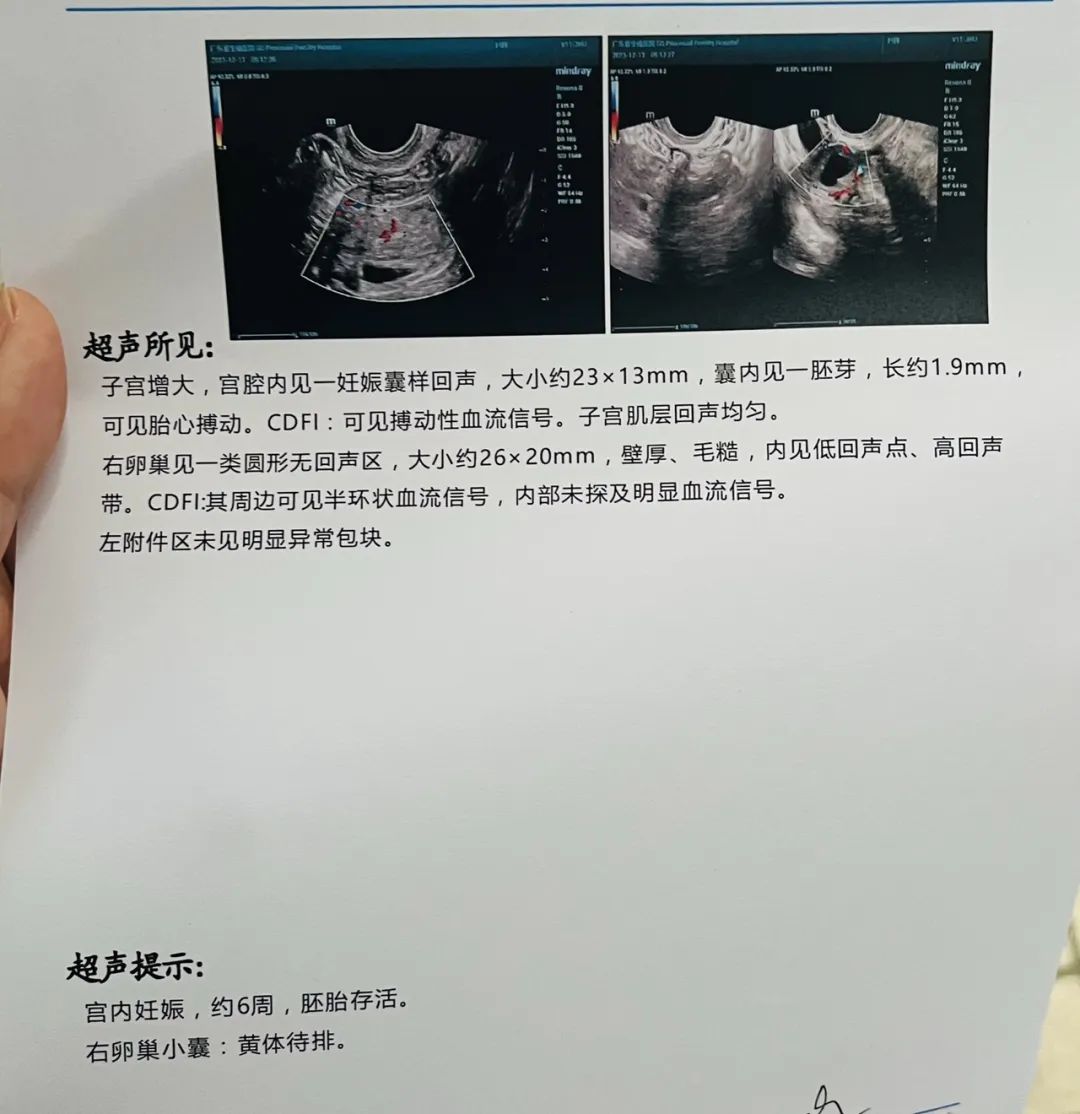 补硒的药推荐一下吃多久（补硒的药）-硒宝网