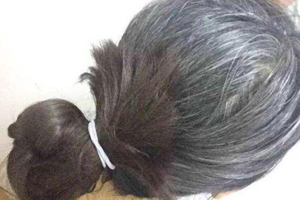 补硒后白发变黄怎么办呢（补硒能让白头发变黑吗）-硒宝网