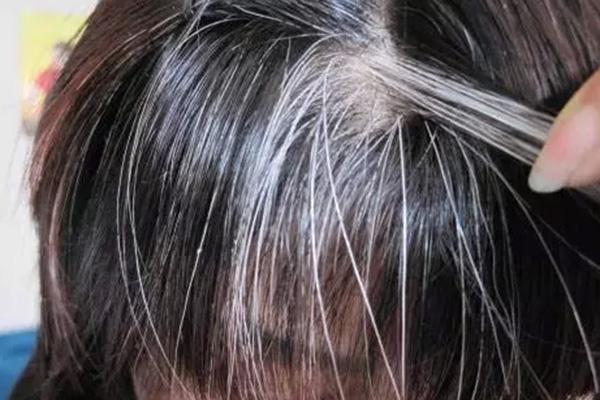 补硒后白发变黄怎么办呢（补硒能让白头发变黑吗）-硒宝网