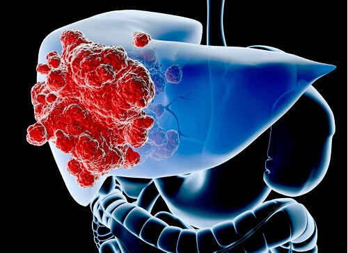 补硒能降甲胎蛋白吗百度(降甲胎蛋白的中草药)-硒宝网