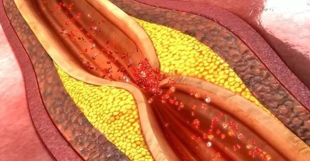 补硒会引起四肢发麻吗吗（补硒会引起四肢发麻吗吗）-硒宝网