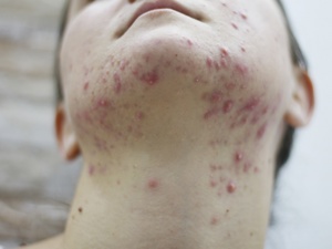 内分泌失调可以补硒吗女(补硒女性)-硒宝网