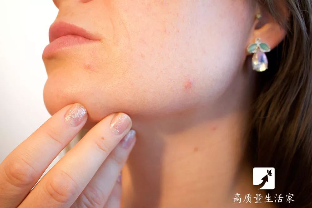 哪些维生素补硒好一点的（维生素硒吃什么）-硒宝网