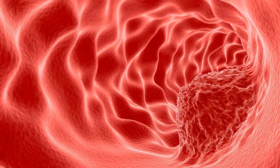 老年人补硒买什么样的好（补硒可以提高老年人的健康水平）-硒宝网